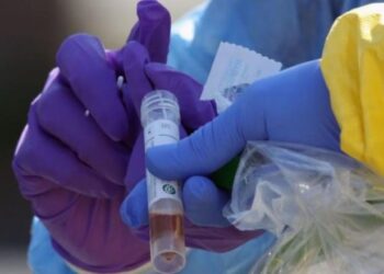 Coronavirus: EEUU autoriza prueba para diagnosticar en unos 45 minutos