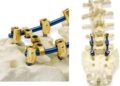 ISORFFIX, innovación médica República Dominicana, tecnología médica Dominicana, productos médicos ortopedia, cirugía maxilofacial RD, sector salud dominicano
