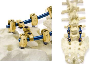 ISORFFIX, innovación médica República Dominicana, tecnología médica Dominicana, productos médicos ortopedia, cirugía maxilofacial RD, sector salud dominicano